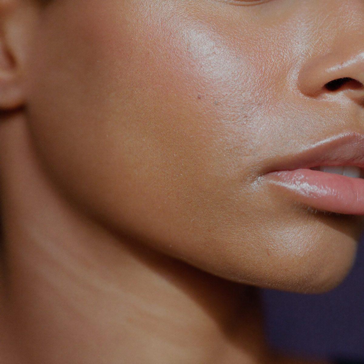 Skin close-up after treatment